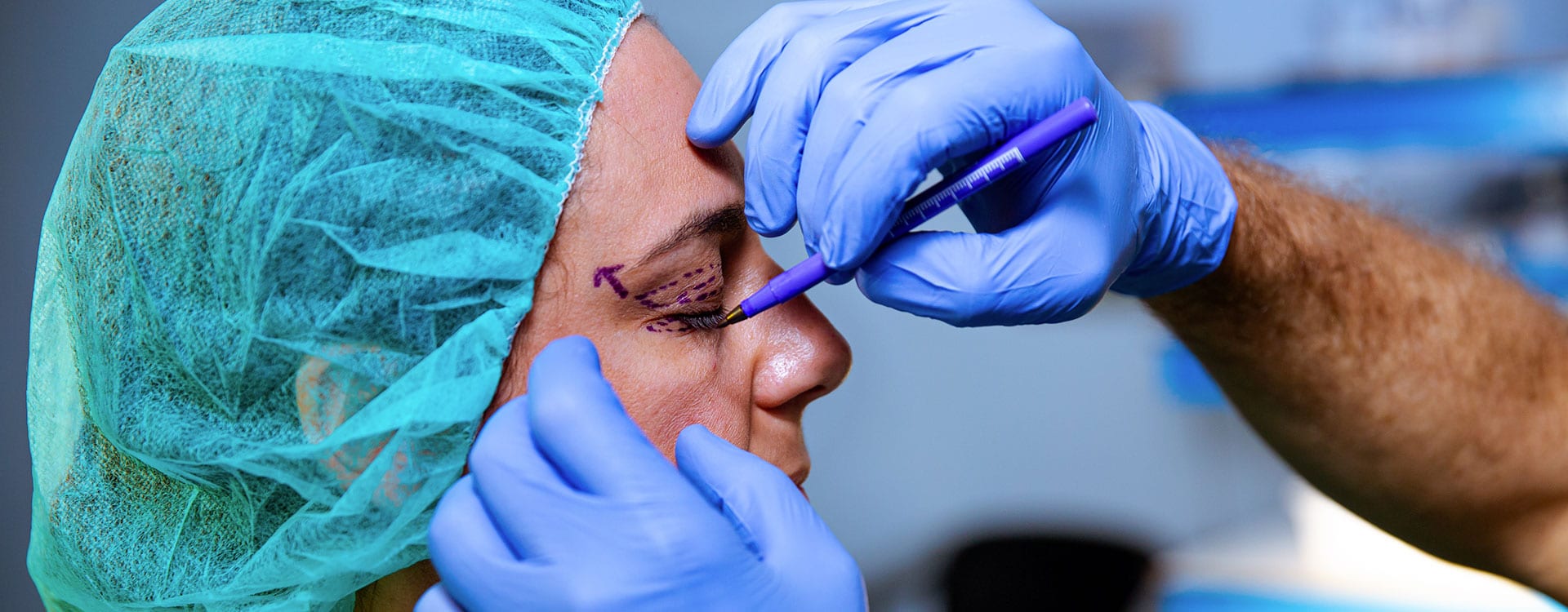 Blefaroplastia en Sevilla: operación de párpados caídos