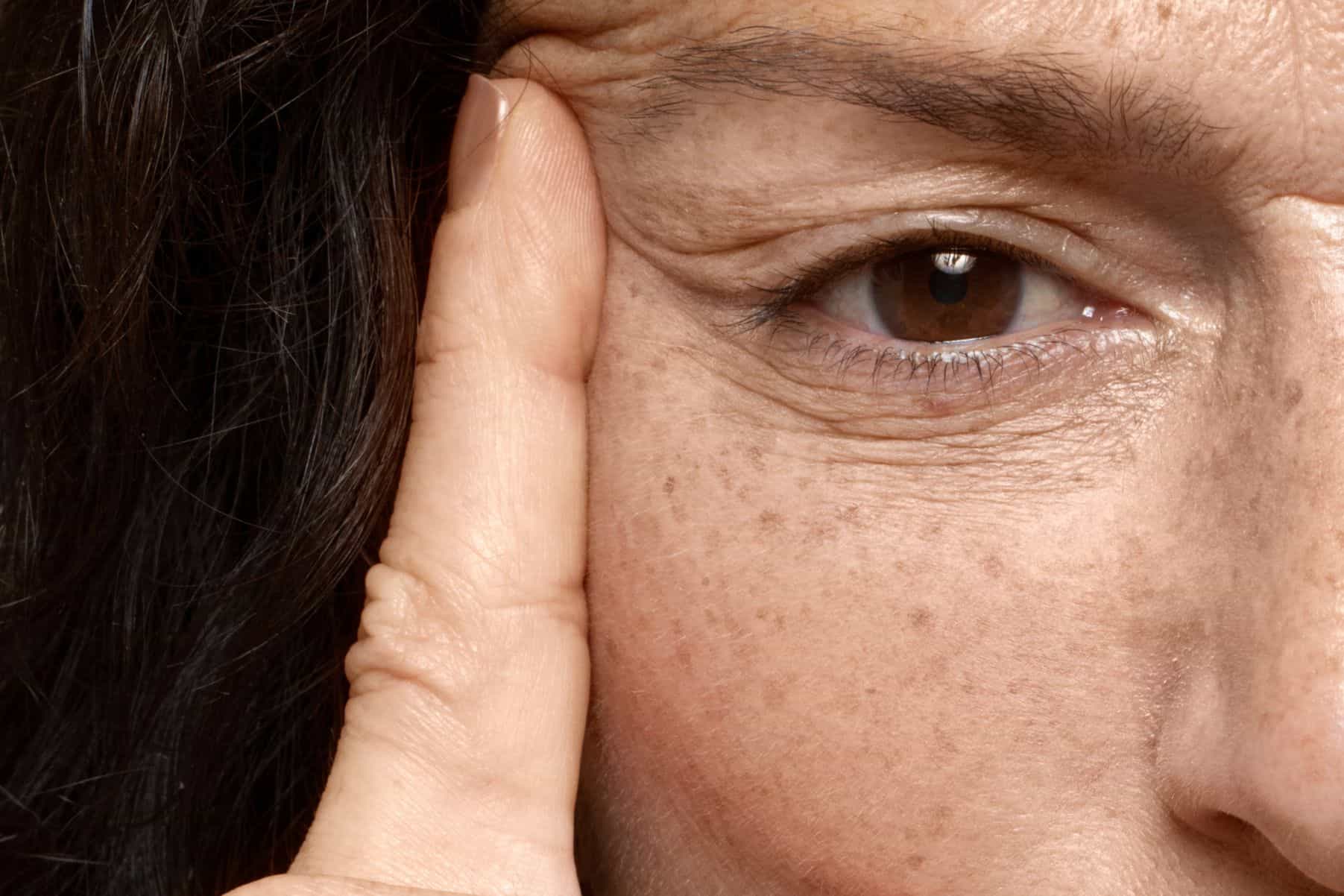 Cómo eliminar manchas de la cara