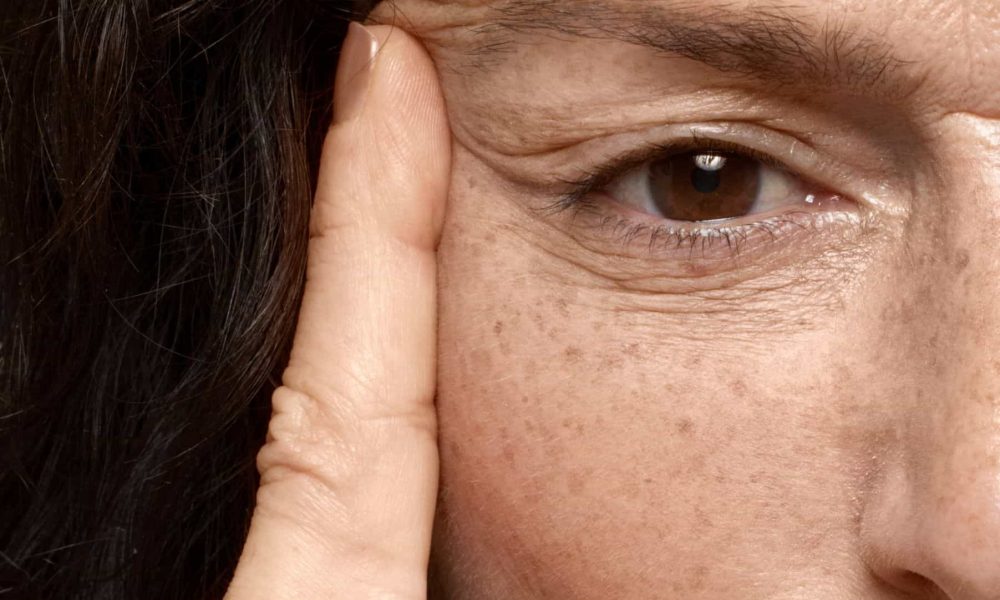 Cómo eliminar manchas de la cara