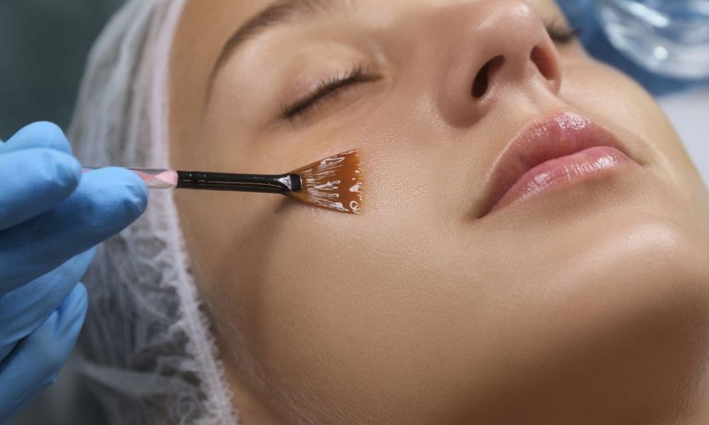 rejuvenecimiento-facial